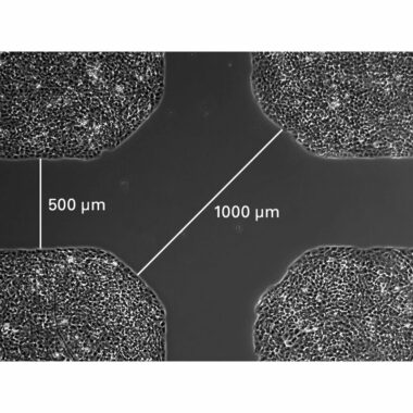 Culture-Insert 4 Well in µ-Dish 35 mm, high