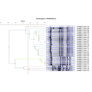 CLIQS Gel Analysis software with advanced analysis functions