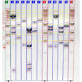 CLIQS Gel Analysis software with advanced analysis functions