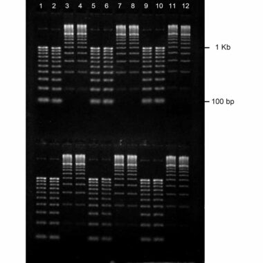 1% Agarose, 1X TAE, 2(12), Portrait, 6.5(w) x 9.5(l)cm, EtBr, 10 gels/Box