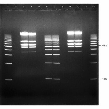 3% Agarose, 1X TAE, 12+1, Long, 11.7(w) x 11.7(l) cm, EtBr, 5 gels/Box