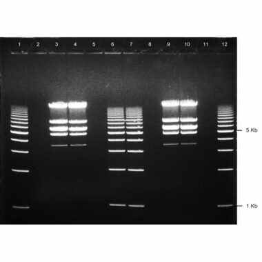 4% Agarose, 1X TAE, 12+1, Medium, 11.7(w) x 8.9(l) cm, EtBr, 5 gels/Box