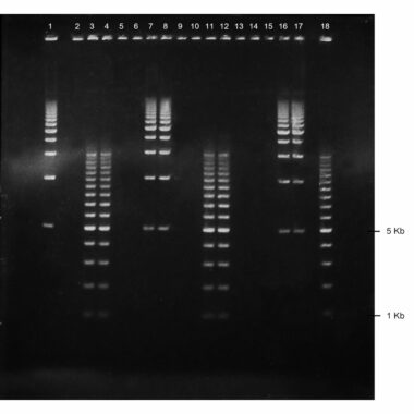 4% Agarose, 1X TAE, 416+2, Long, 11.7(w) x 11.7(l) cm, EtBr, 5 gels/Box
