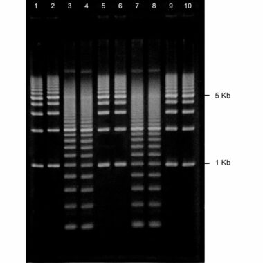 1% Agarose, 1X TAE, 10, Portrait, 6.5(w) x 9.5(l)cm, EtBr, 10 gels/Box
