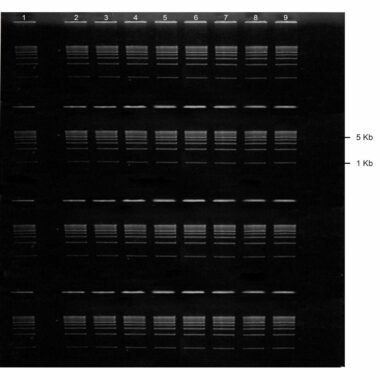 1% Agarose, 1X TBE, 4(8+1), Long, 11.7(w) x 11.7(l) cm, EtBr, 5 gels/Box