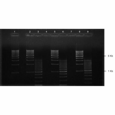 1% Agarose, 1X TBE, 1+1, Medium, 11.7(w) x 8.9(l) cm, EtBr, 5 gels/Box