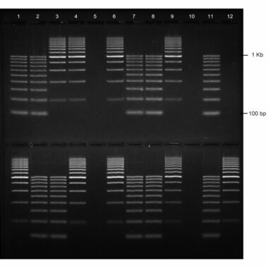 1% Agarose, 1X TBE, 2(12+1), Long, 11.7(w) x 11.7(l) cm, EtBr, 5 gels/Box