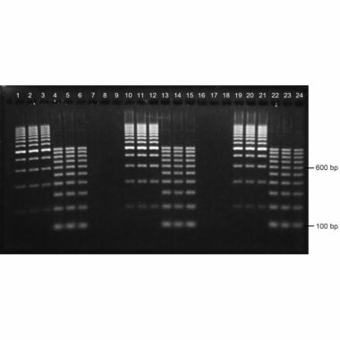 3% Agarose, 1X TBE, 24+1, Landscape, 11.7(w) x 5.6(l)cm, EtBr, 10 gels/Box