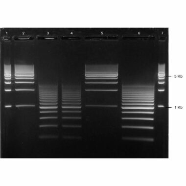 1% Agarose, 1X TAE, 5+2, Medium, 11.7(w) x 8.9(l) cm, GelGreen, 5 gels/Box