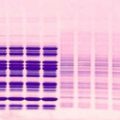 Bis-Tris Gels (Homogeneous)