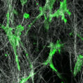 Collagen Type I