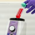 Variable Speed Vortex Mixer