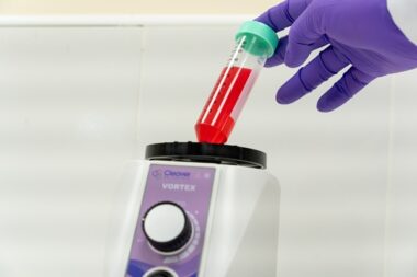 Variable Speed Vortex Mixer