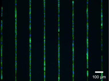 μ-Slide 8 Well high μ-Pattern ibiTreat, lin20, pit170