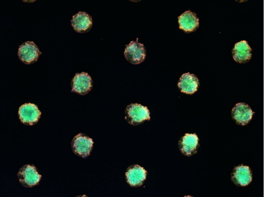 µ-Slide VI 0.4 µ-Pattern ibiTreat, cir200, pit600, hex