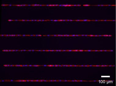 μ-Slide VI 0.4 μ-Pattern ibiTreat, lin20, pit170